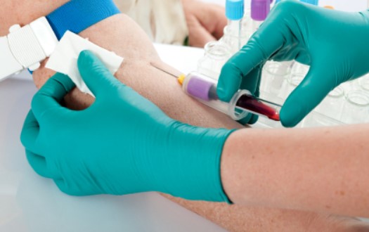 Therapeutic Phlebotomy Side Effects